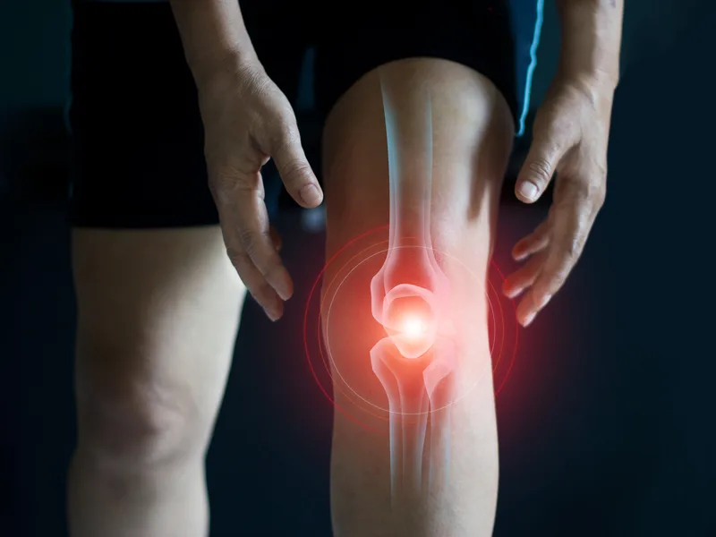 How we treat arthritis